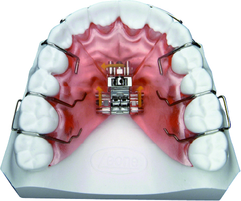 TORNILLO DE EXPANSIÓN - Image 2